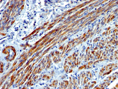 2 -  Smooth Muscle Myosin Heavy Chain (SM-MHC) (Leiomyosarcoma & Myoepithelial Cell Marker) Antibody - W AH11953