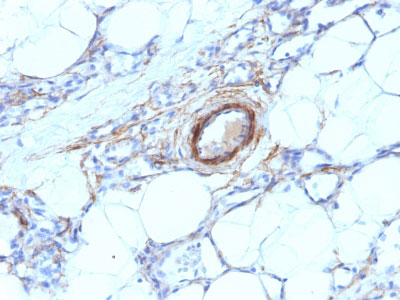 2 -  Smooth Muscle Myosin Heavy Chain (SM-MHC) (Leiomyosarcoma & Myoepithelial Cell Marker) Antibody - W AH11953
