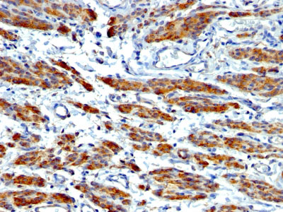 2 -  Smooth Muscle Myosin Heavy Chain (SM-MHC) (Leiomyosarcoma & Myoepithelial Cell Marker) Antibody - W AH11956