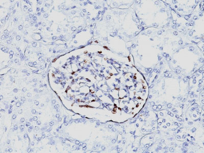 2 -  Wilm's Tumor 1 (WT1) (Wilm's Tumor & Mesothelial Marker) Antibody - With BSA and Azide AH12524