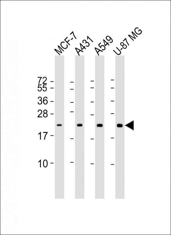 1 - RAB13 Antibody AM8693b