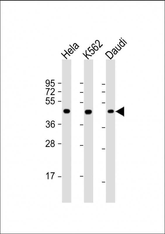 1 - PLIN3 Antibody AM8538b