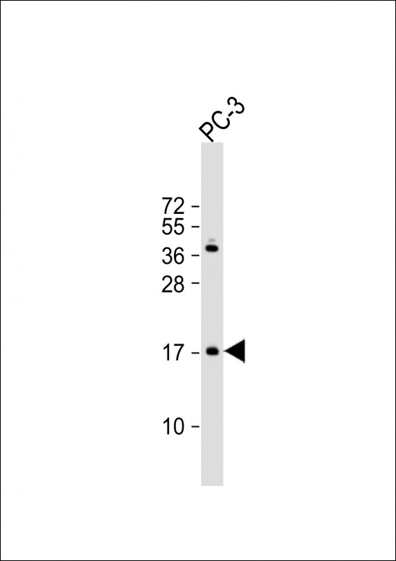 1 - NDUF3 Antibody (N-term) AP10989a