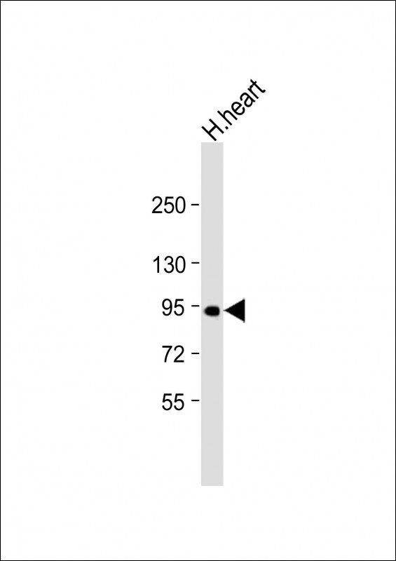 1 - PPP1R3F Antibody (C-term) AP13676b