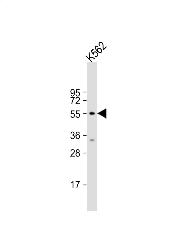 1 - HYAL4 Antibody (Center) AP13683C
