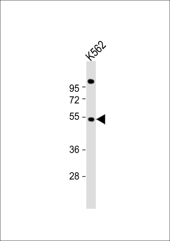1 - EIF2B3 Antibody (C-term) AP17027B