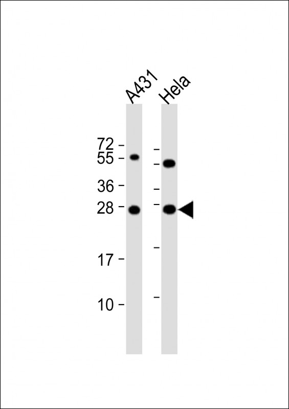 1 - PSPH Antibody (N-term) AP20207A