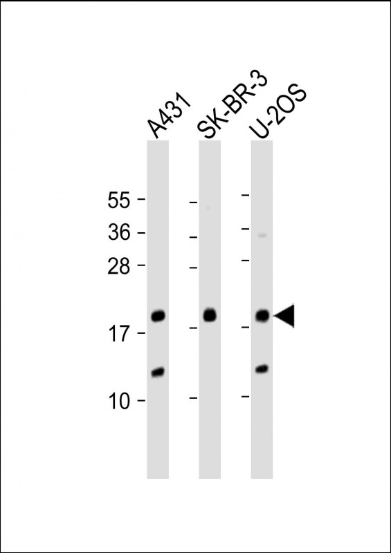1 - THRSP Antibody (N-Term) AP21996a