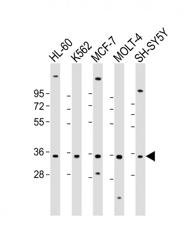 1 - PIGC Antibody (Center) AP21999c