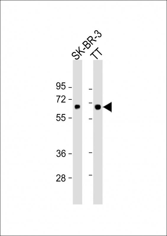 1 - SLC5A8 Antibody (C-Term) AP22009b