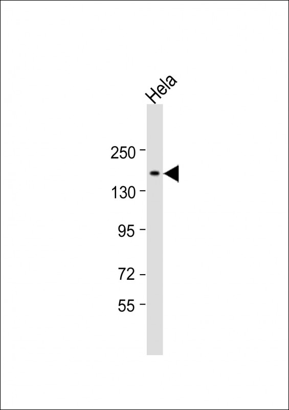 1 - CHD5 Antibody (N-Term) AP22011a