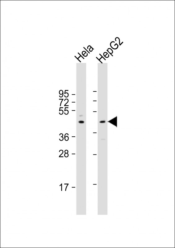 1 - CERS2 Antibody (Center) AP22022c