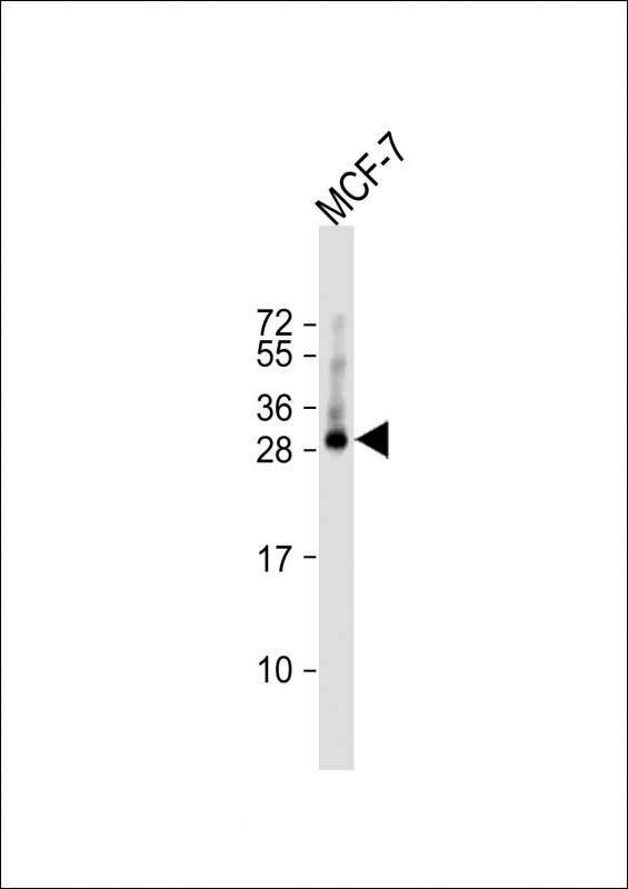 1 - TMEM111 Antibody  (N-term) AP5782a