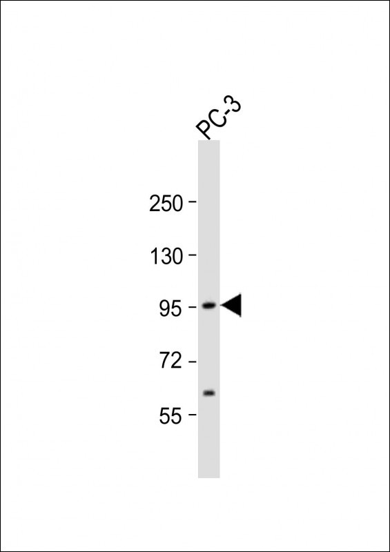 1 - ST14 Antibody (C-term) AP6248a
