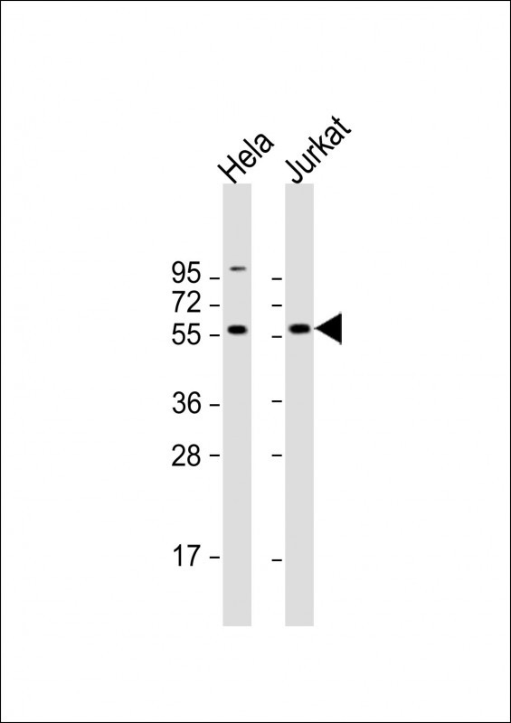 1 - CREB3L2 Antibody (C-term) AP9654b