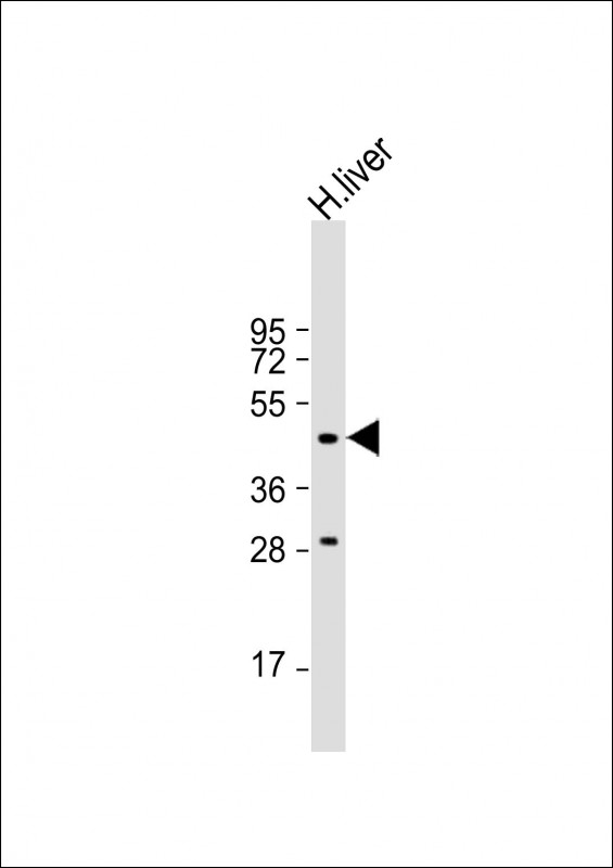 1 - MMAA Antibody (N-term) AP9795a