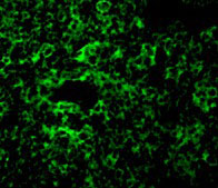 3 - TAK1 Antibody ASC10265