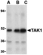 1 - TAK1 Antibody ASC10265