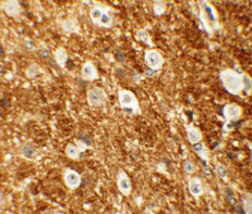 2 - ROCK2 Antibody ASC11319