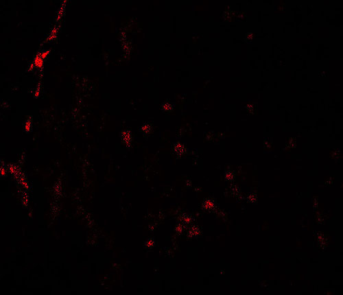 3 - HDAC2 Antibody ASC11825