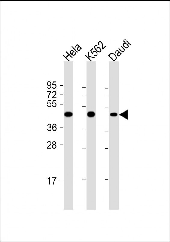 1 - PLIN3 Antibody AM8698b