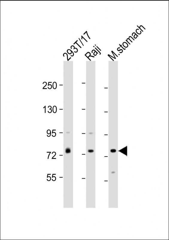 1 - PLA2G4F Antibody (Center) AP22037c