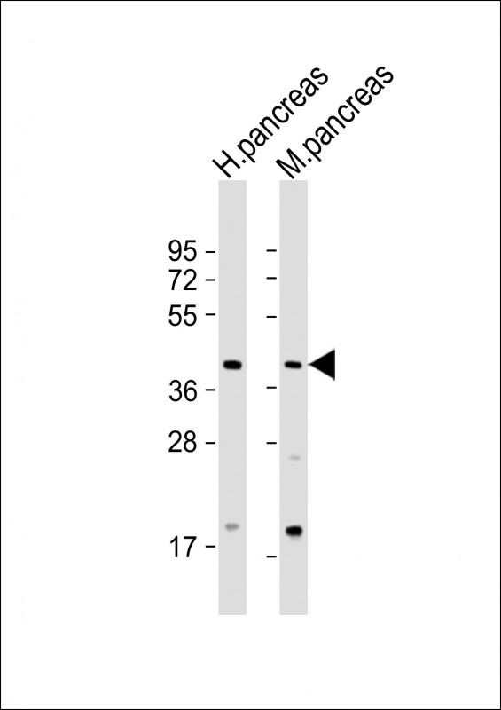 1 - GMPPB Antibody (N-Term) AP22042a