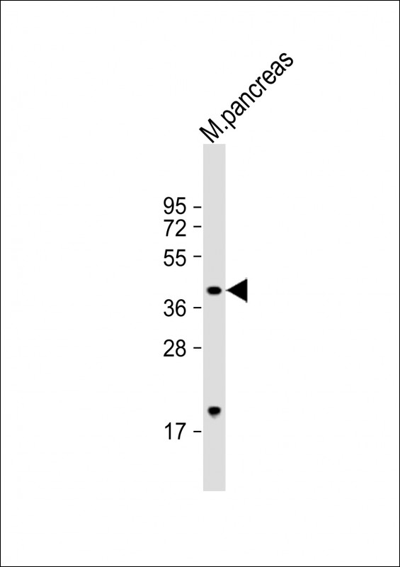 1 - GMPPB Antibody (Center) AP22043c