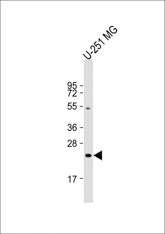 1 - LHPP Antibody (Center) AP22044c