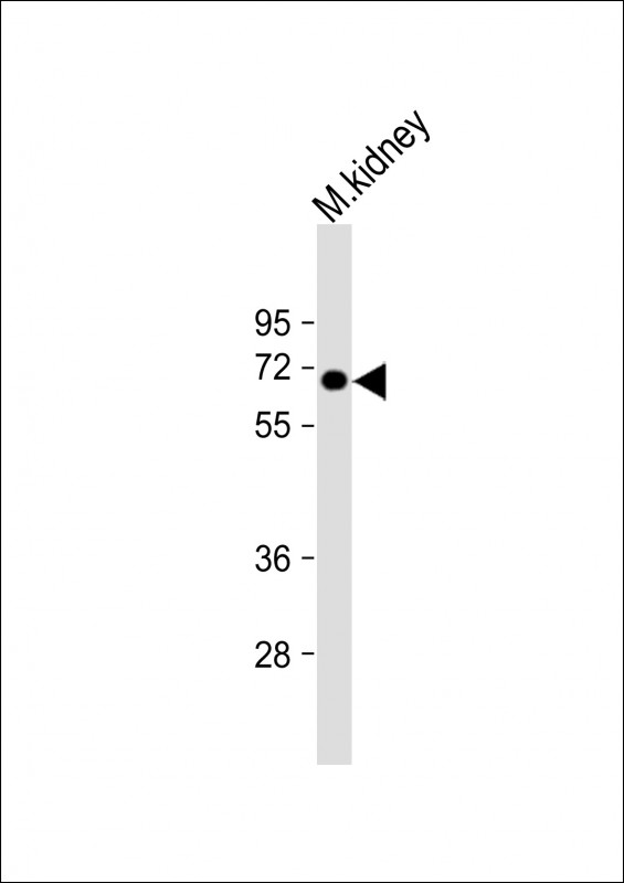 1 - MGAT4A Antibody (N-Term) AP22052a