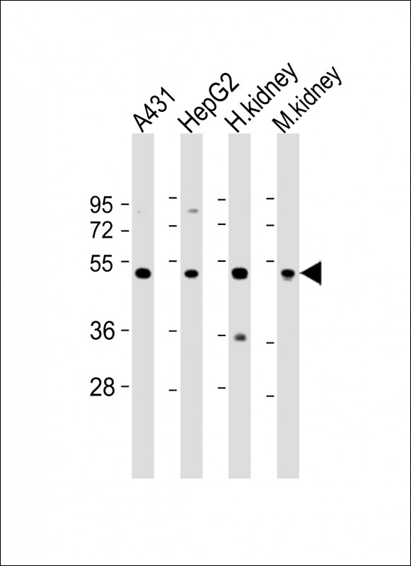 1 - VNN1 Antibody (N-Term) AP22056a