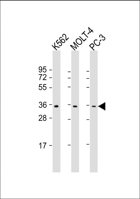 1 - PIGC Antibody (C-Term) AP22091b