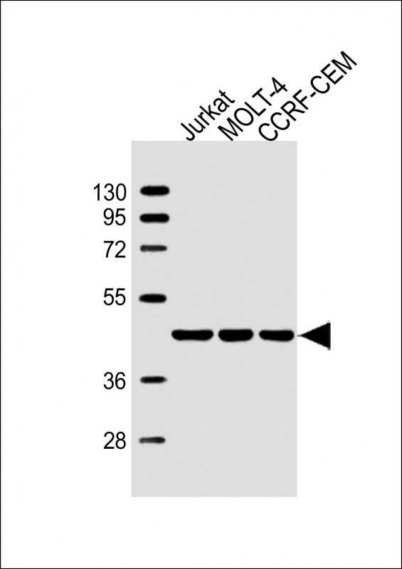 1 - ADA Antibody (C-term) AW5620