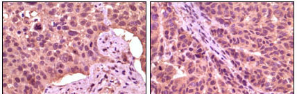 2 - GSK3 alpha Antibody AO1070a