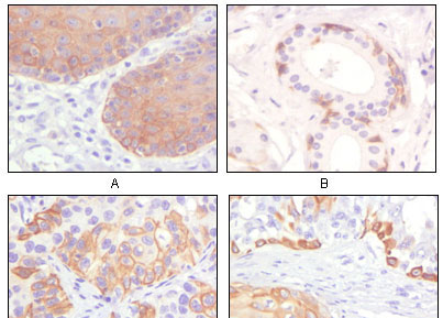 2 - Cytokeratin 5 Antibody AO1115a
