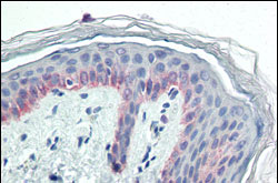 2 - Cytokeratin 5 Antibody AO1115a