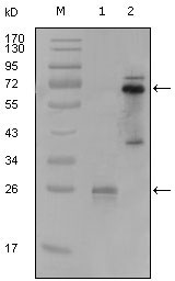 1 - SYK Antibody AO1175a