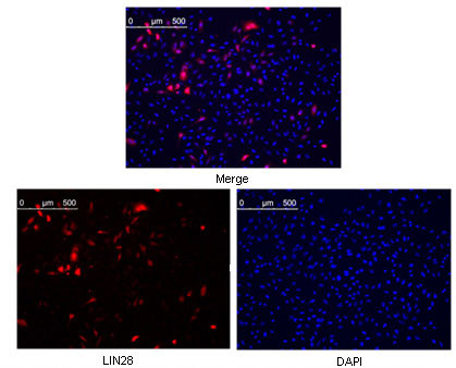 3 - NCOR1 Antibody AO1216a