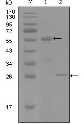 1 - PGR Antibody AO1219a
