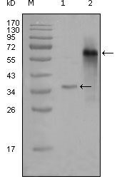 1 - NCOA3 Antibody AO1225a