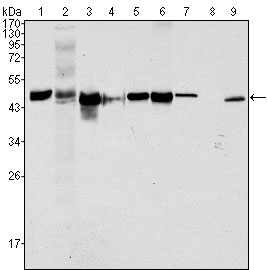 1 - Cytokeratin 18 Antibody AO1227a