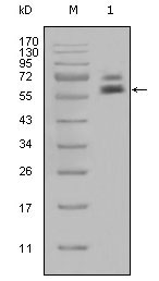 1 - Cytokeratin 5 Antibody AO1263a