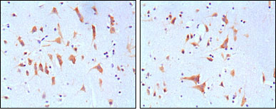 2 - FMR1 Antibody AO1268a