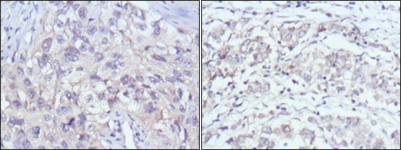 2 - CD18 Antibody AO1286a
