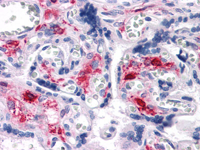2 - NKX3A Antibody AO1380a