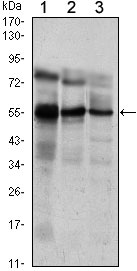 1 - ETV5 Antibody AO1408a