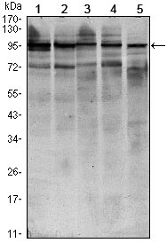 1 - STAT6 Antibody AO1421a