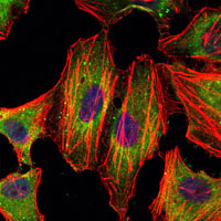 3 - STAT3 Antibody AO1474a