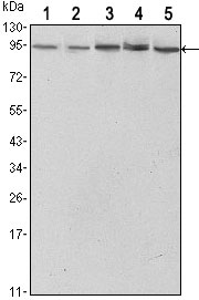 1 - STAT3 Antibody AO1474a
