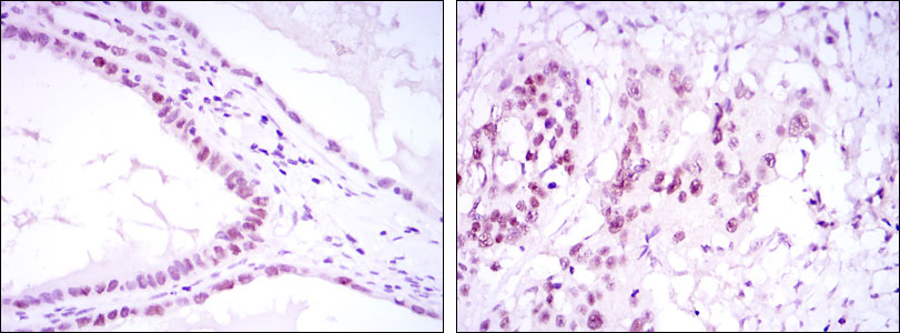 2 - SUZ12 Antibody AO1495a